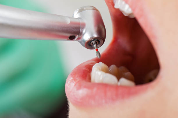 Best Same-Day Emergency Dentist in Bon Air, VA